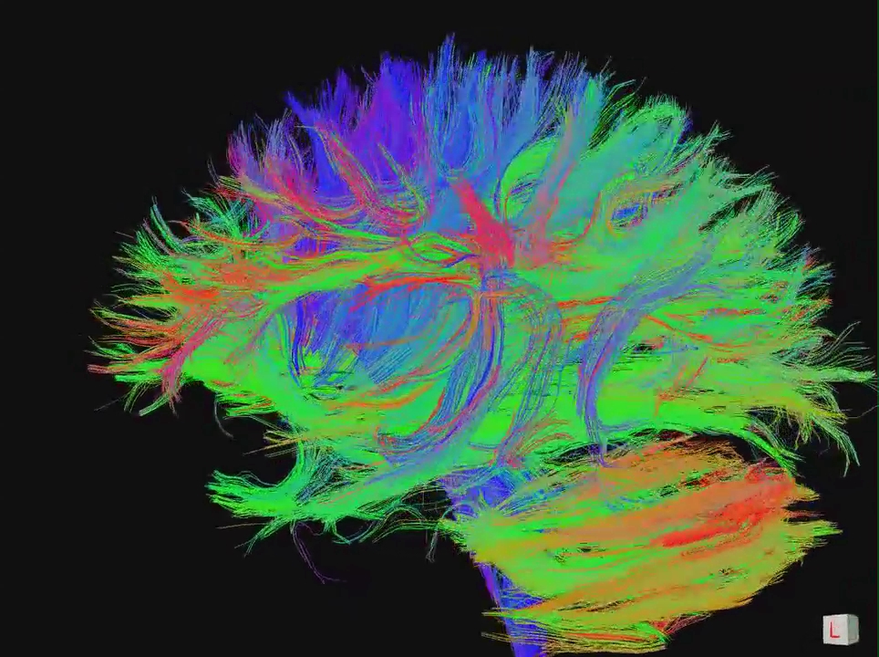 Conférence-débat : « Le cerveau apprenant » le 27/11/2019 à Roubaix